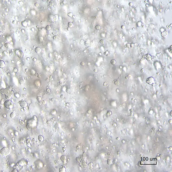 Bovine respiratory organoids in Matrigel